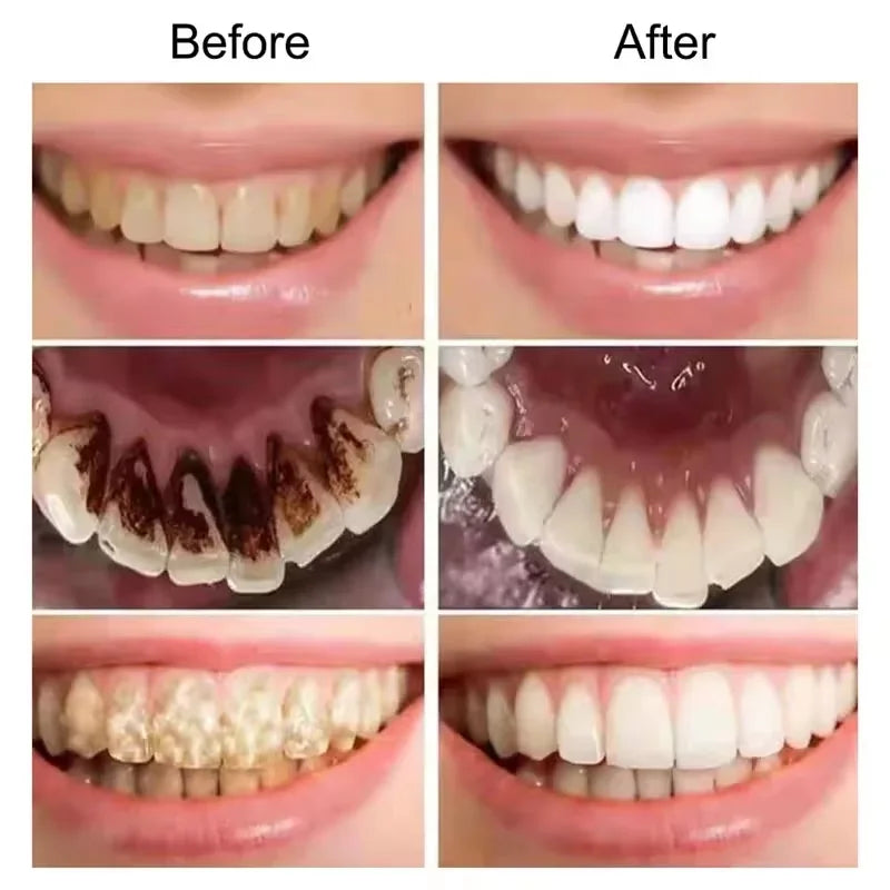 Dentifrice Blanchissant Violet V34 | Élimine Plaque & Taches | Haleine Fraîche | Hygiène Dentaire