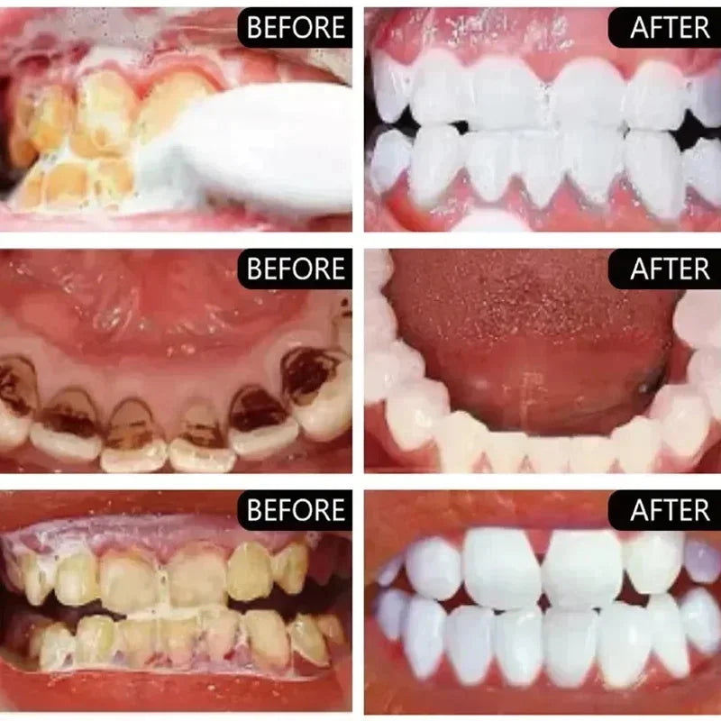 Dentifrice Blanchissant Violet V34 | Élimine Plaque & Taches | Haleine Fraîche | Hygiène Dentaire