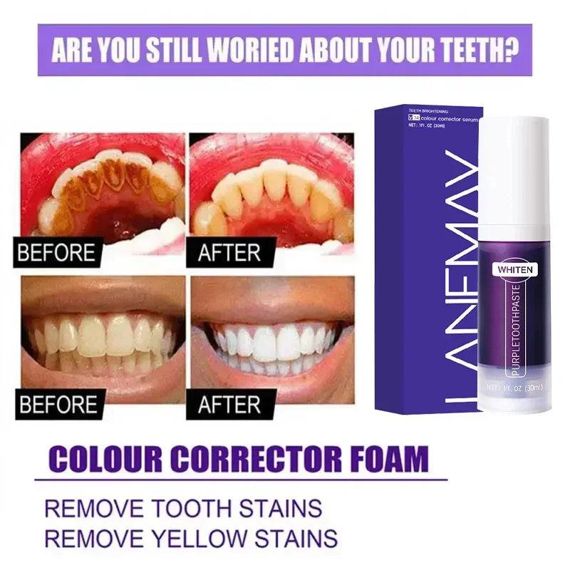 Dentifrice Blanchissant Violet V34 | Élimine Plaque & Taches | Haleine Fraîche | Hygiène Dentaire