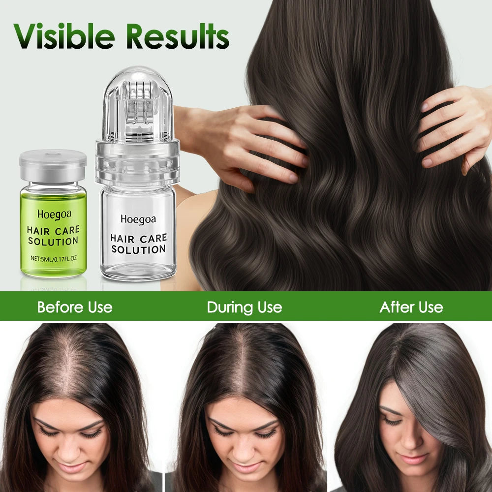 Sérum Capillaire Anti-Chute | Renforce Racines | Réduit Calvitie | Nourrit Cuir Chevelu | Conditionneur
