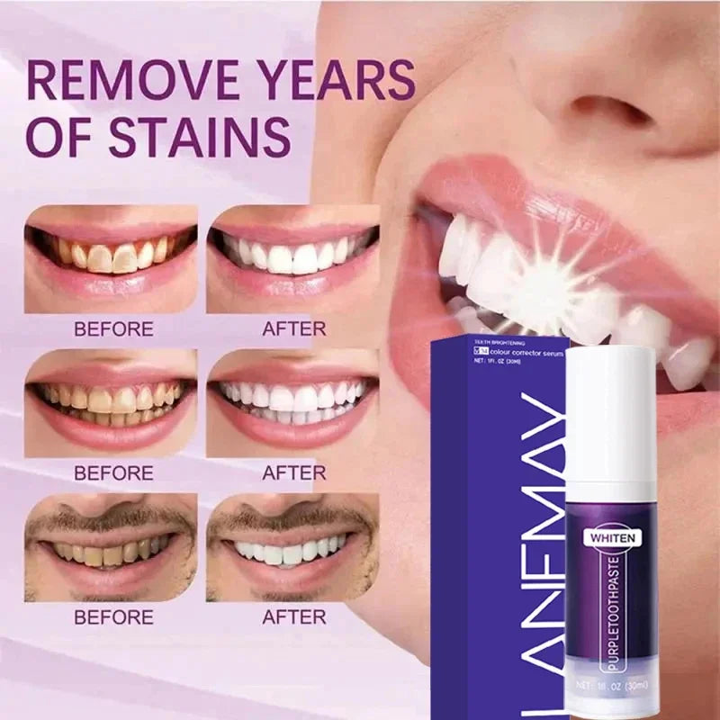 Dentifrice Blanchissant Violet V34 | Élimine Plaque & Taches | Haleine Fraîche | Hygiène Dentaire