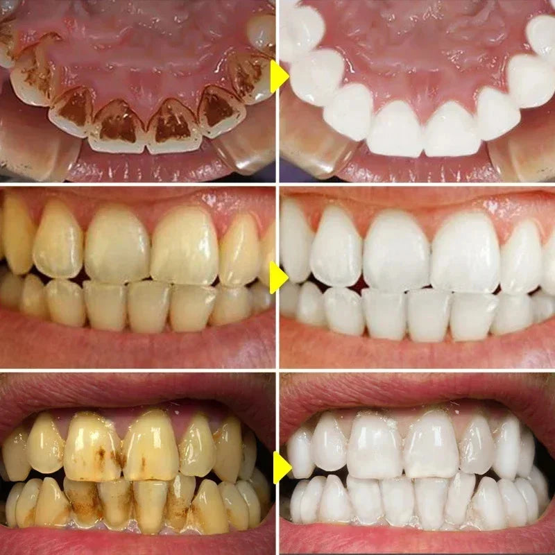 Dentifrice Blanchissant Violet V34 | Élimine Plaque & Taches | Haleine Fraîche | Hygiène Dentaire