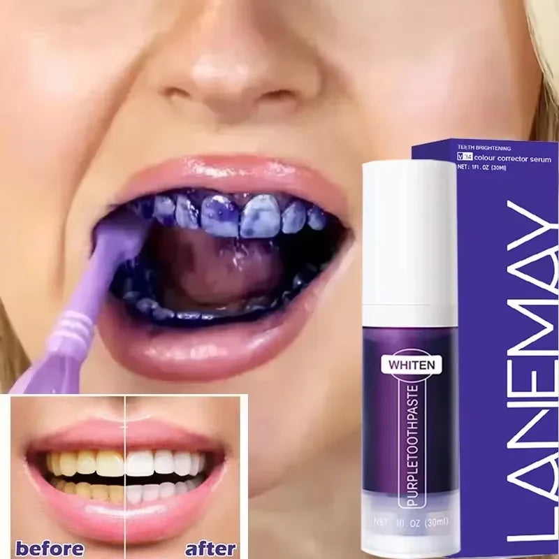 Dentifrice Blanchissant Violet V34 | Élimine Plaque & Taches | Haleine Fraîche | Hygiène Dentaire