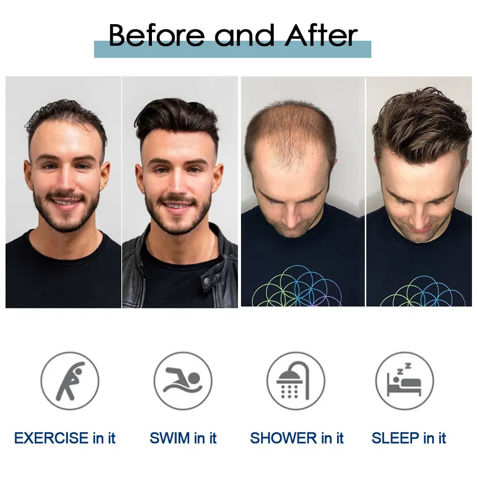 Perruque Tresses Twist Homme Indétectable | Prothèse Capillaire Crochet | Peau | Hair System | Homme Noir
