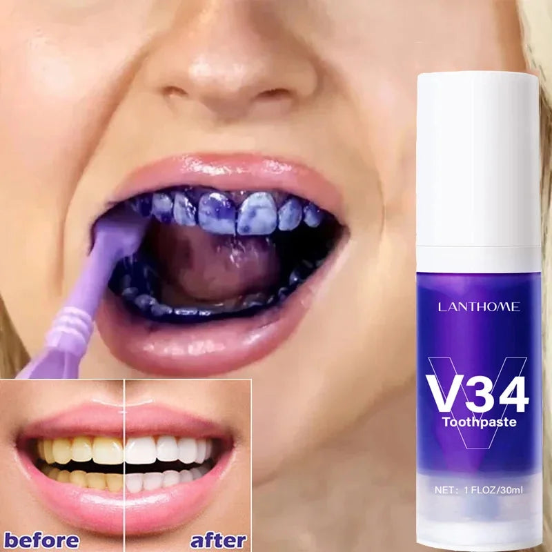 Dentifrice Blanchissant Violet V34 | Élimine Plaque & Taches | Haleine Fraîche | Hygiène Dentaire