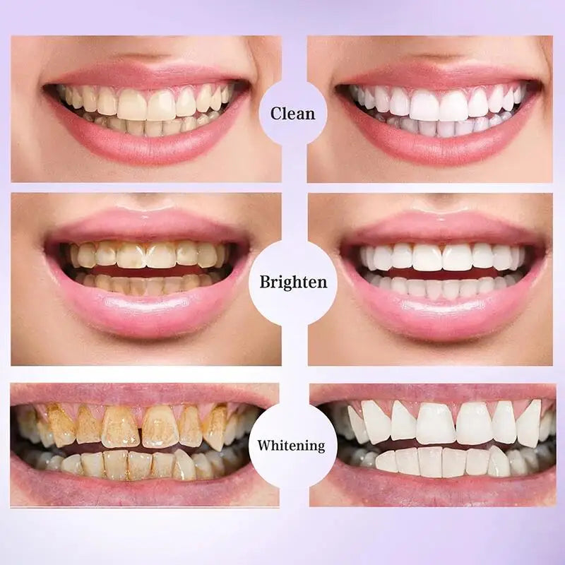 Dentifrice Blanchissant Violet V34 | Élimine Plaque & Taches | Haleine Fraîche | Hygiène Dentaire